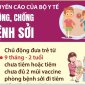 BỘ Y TẾ KHUYẾN CÁO PHÒNG BỆNH SỞI ĐỐI VỚI NHÓM CÓ NGUY CƠ CAO