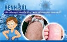 BÀI TUYÊN TRUYỀN PHÒNG, CHỐNG BỆNH SỞI